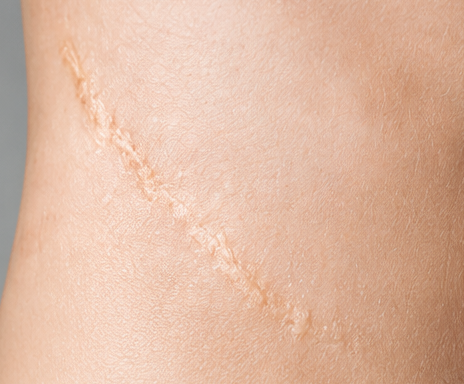 Old Scars